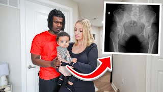 WE HAD TO TAKE KYLAH TO A SURGEON FOR HIP DYSPLASIA [upl. by Stein]