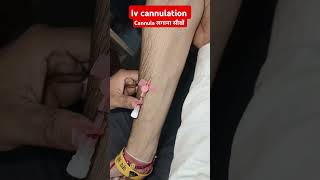 Iv cannula shorts trending viralvideos video iv injection drxsachinsaini12 [upl. by Nomit]