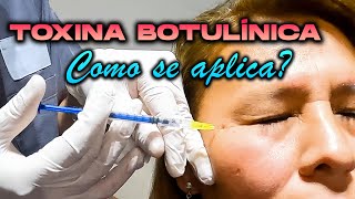 CURSO de TOXINA BOTULINICA  BOTOX ✅ 🔴Como se aplica QUE CUIDADOS 🤔 [upl. by Iba753]