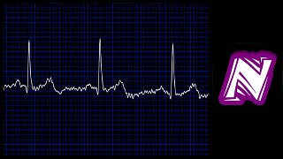 Sonido de monitor cardiaco  Heart monitor sound effect  Ekg sound  Sonido electrocardiograma [upl. by Gradey]