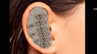 ASMR ear cleaning deep treatment 2d animation video [upl. by Baskett]