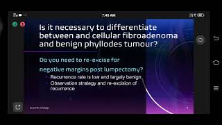 NBE APPROACH TO PHYLLODES BREAST TUMOR AND ITS MANAGEMENT DR MJ PAUL [upl. by Ner9]