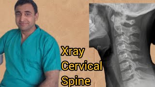 cervical spine x ray  cervical spine anatomy  how to interpret x ray neck  normal part 1 [upl. by Rebeca]