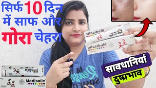 Medisalic Cream Review in Hindi  गोरेपन की क्रीम  Medisalic Cream Side effects Uses and Results [upl. by Ianthe423]