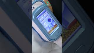 Labelles Advanced Cryolipolysis Treatment [upl. by Alfy]