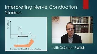 Interpreting Nerve Conduction Studies [upl. by Aicilav]