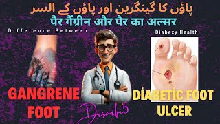 Gangrene foot versus Diabetic foot ulcer  Diabetic Gangrene Foot  Diabetic foot ulcer [upl. by Dotti]