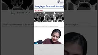 Dr Zainab Vora Explains Imaging of Paranasal Sinuses  Conceptual Radiology [upl. by Kristi]