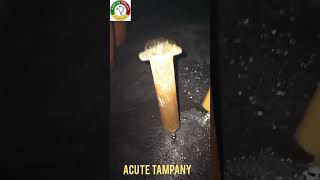 Acute Tempany in Buffalo buffalovideo veterinary veterinarymedicine veterinary cowmilk [upl. by Annawik]