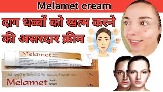 Melamet cream  Melamet cream uses in Hindi  Melamet cream ke fayde  दाग धब्बों के लिए shorts [upl. by Hebert636]