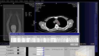 CT Scan Of Upper Limb Angio [upl. by Va]