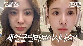 SUB Vlog  얼굴이 달라진 이유  쥬베룩 볼륨 후기  콜라겐주사👼🏻  쇼핑 하울🛍️  미드 보며 영어공부 하는 법  시티브리즈 모델👗 테라스에서 가을 만끽🍁 [upl. by Mirielle]