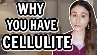 WHY YOU HAVE CELLULITE amp HOW TO GET RID OF IT  Dermatologist DrDrayzday [upl. by Elttil]