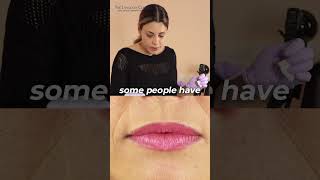 Lip Augmentation LIVE DEMO [upl. by Oyr432]