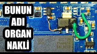 BUNUN ADI ORGAN NAKLİ XIAOMI MI STICK TAMİRİ [upl. by Hyland612]