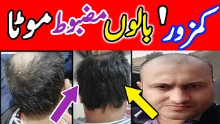 4 Months Course Medicine  Short Medicine Formula  how to Control Hairfall [upl. by Hamal]