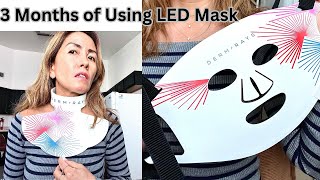 DermRays Light Therapy Mask Review 3 Months Later BIG Results [upl. by Anyalram]