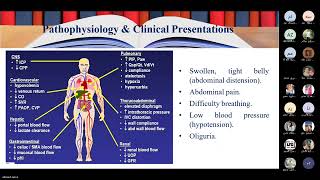 compartment syndrome abdominal [upl. by Pudendas83]