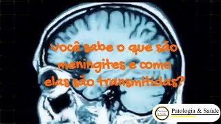 MENINGITE EM CRIANÇAS [upl. by Enisamoht]