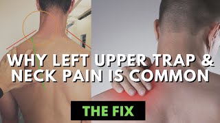 The Curious amp Common Case of Left Upper Trap and Neck Tightness  The Fix [upl. by Anerol]