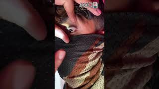 Anisocoria EYE 👁️ Medical points 🤔 आप भी चेक कर लो armymedical viralvideo [upl. by Hamachi]