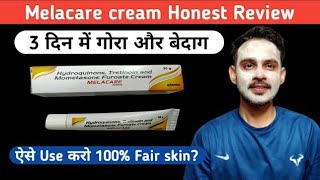 Melacare cream review  melamet cream  gora karni wali Cream  melacare cream side effects [upl. by Nidraj783]