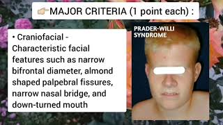 Prader Willi Syndrome Genetics Symptoms and Diagnosis [upl. by Colvert975]