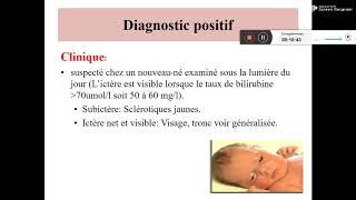 ICTERES NEONATAUX Dr DJEGHALI [upl. by Lyrad]