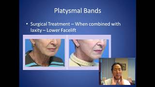 How Can I Soften the Look of my Neck  Platysmal Bands Consultation  Dr Anthony Youn [upl. by Eitten]