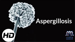 Aspergillosis Everything You Need To Know [upl. by Aikkin]