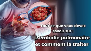 Lembolie pulmonaire  un risque fréquent mais souvent méconnu Voici comment se protéger [upl. by Graehme698]