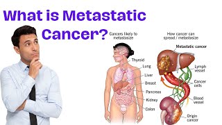 Understanding Metastasis  What is Metastatic Cancer [upl. by Aurore]