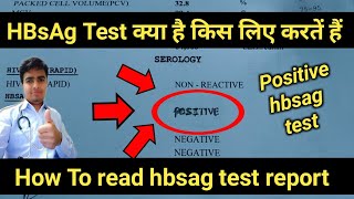 Hbsag Positive  hbsag test  hbsag test in hindi  hbsag test report  hepatitis b test results [upl. by Prestige525]