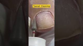 Toenail Cleaning nailart pedicure nails shorts [upl. by Kapeed]