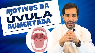 Úvula sininho campainha da garganta está inchada o que pode ser [upl. by Ymarej590]