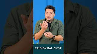 Epididymal Cyst drhealth maleinfertility spermcount himanshudhawan shorts viralshorts [upl. by Marguerie264]