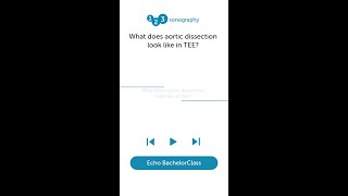 What does aortic dissection look like in TEE [upl. by Adila]