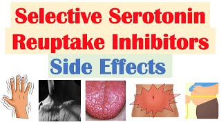 SSRI Antidepressant Side Effects amp Why They Occur  Fluoxetine Paroxetine Sertraline Citalopram [upl. by Comfort19]