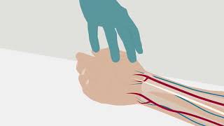 How to perform an arterial puncture PL – Radiometer [upl. by Ojeitak295]