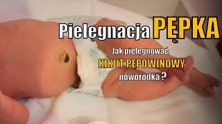 Pielęgnacja pępka i kikuta pępowinowego [upl. by Eyeleen]