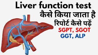 Liver function test in Hindi  lft blood test result in Hindi  lft normal range [upl. by Chari]