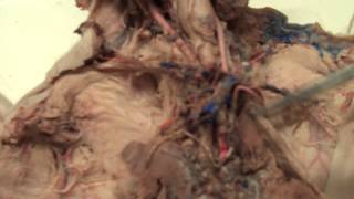 Fetal Pig Dissection 44 Arteries Cranial to the Heart [upl. by Colis]