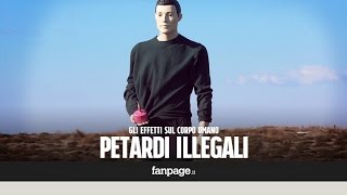 Gli effetti devastanti di un petardo illegale sul corpo umano [upl. by Boykins]