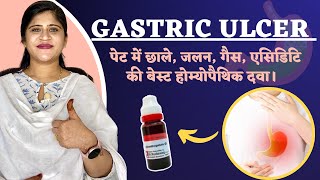 Gastric ulcer  पेट में छाले जलन बदहज़्मी की बेस्ट दवा  Peptic ulcer Treatment  Dr Arwa Bohra [upl. by Ellehsor]