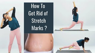 Exercise for Stretch Marks at home  Toning Workout  Somya Luhadia [upl. by Hahseram]