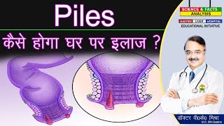 Piles कैसे होगा घर पर इलाज   HAEMORRHOIDS AN OVER VIEW [upl. by Dnesnwot]