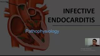 infective endocarditis  part 1   تم اضافة ال power point [upl. by Atirehc]