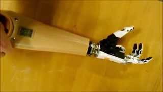 bebionic prosthetic hand [upl. by Noreen642]