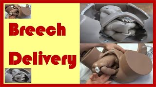 Breech Delivery  Mechanism of Labour in Breech Presentation [upl. by Redan]