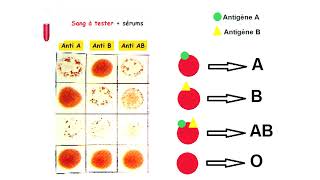 Les groupes sanguins et la transfusion sanguine [upl. by Garibold405]